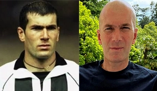 Terceiro Tempo - Antes e Depois - Zin&eacute;dine Zidane