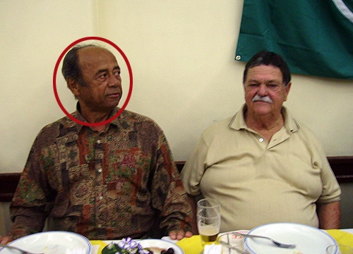 Eraldo Cabeção - Ex-zagueiro do Guarani, que "parou Pelé"