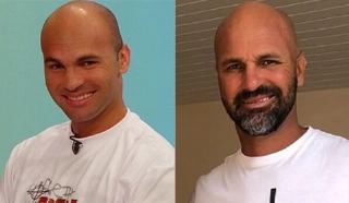 Terceiro Tempo - Antes e Depois - F&aacute;bio Baiano