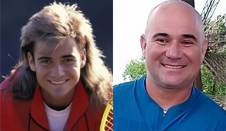 Terceiro Tempo - Antes e Depois - Andre Agassi