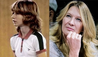 Terceiro Tempo - Antes e Depois - Steffi Graf