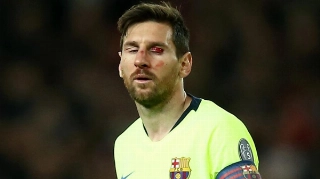 Messi tem rosto machucado durante partida do Barcelona na Liga dos Campeões. Foto: Jan Kruger - UEFA/UEFA via Getty Images/Via UOL