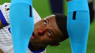 Atacante se lesionou na estreia da França na Eurocopa. Foto: Divulgação